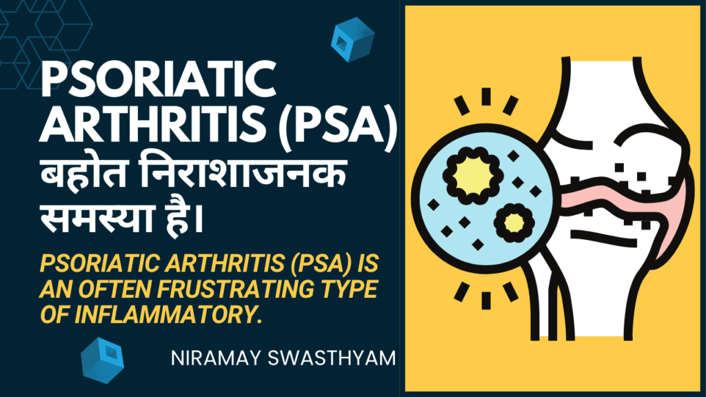 PSORIATIC गठिया (PSA) एक अक्सर निराशाजनक है | PSORIATIC ARTHRITIS IS AN OFTEN FRUSTRATING TYPE OF INFLAMMATORY.